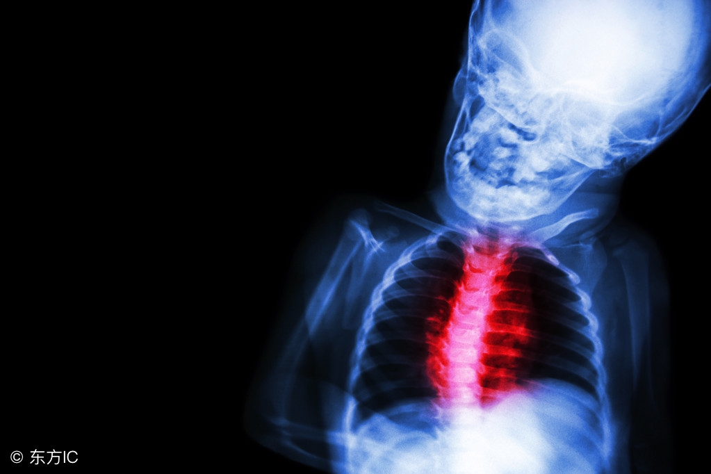 风湿性心脏病的症状有什么呢,先天性风湿性心脏病后期症状