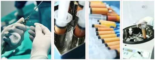 自体脂肪填充川字纹保持多久,自体脂肪填充10天内效果图