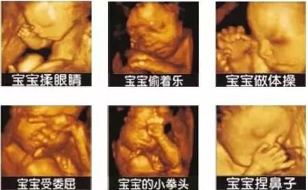 四维胎宝宝笑,宝宝在妈妈肚子里四维的全过程