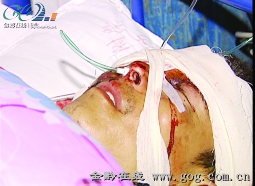 被鞭炮炸伤眼睛晶体要怎么补救,13岁男孩被鞭炮炸伤眼睛