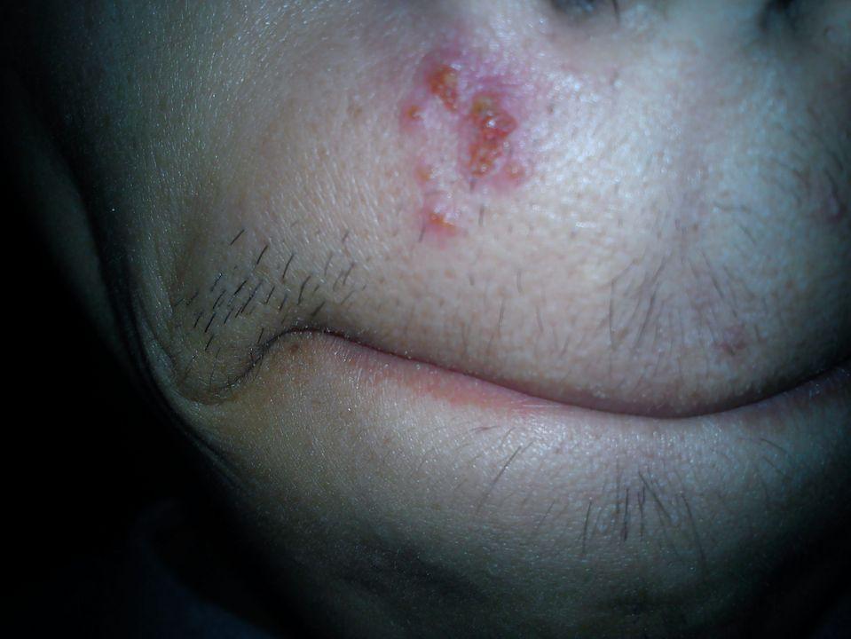 过年大鱼大肉吃什么解腻,过年大鱼大肉少不了多吃这些东西