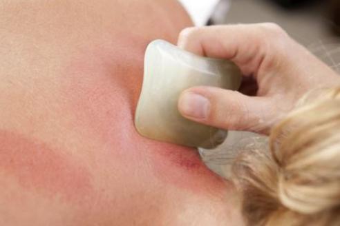 风寒感冒刮痧刮哪个部位,感冒鼻子不通气刮痧刮哪个部位