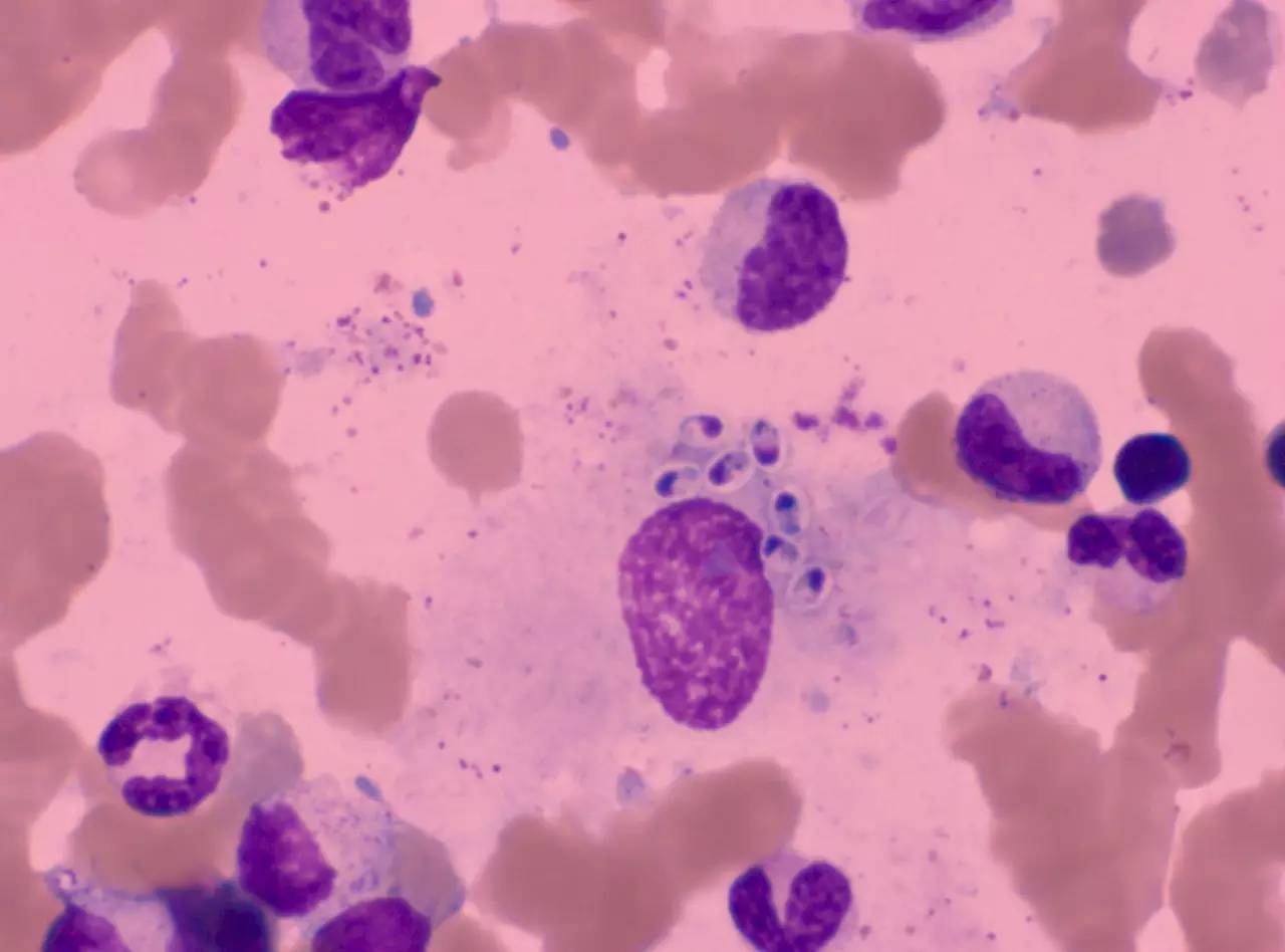 胞浆内颗粒减少,胞浆内颗粒增多