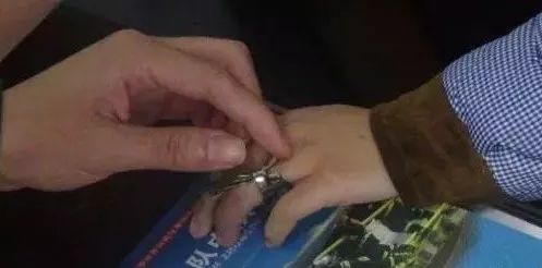 疼！家长们注意：熊孩子这样玩，钢丝刺穿右手中指！