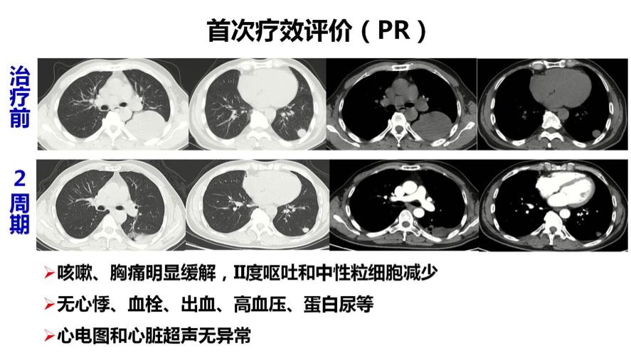 华莹奇医生援鄂了吗,华莹奇