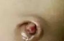 月嫂分享：新生儿肚脐5个异常要注意！