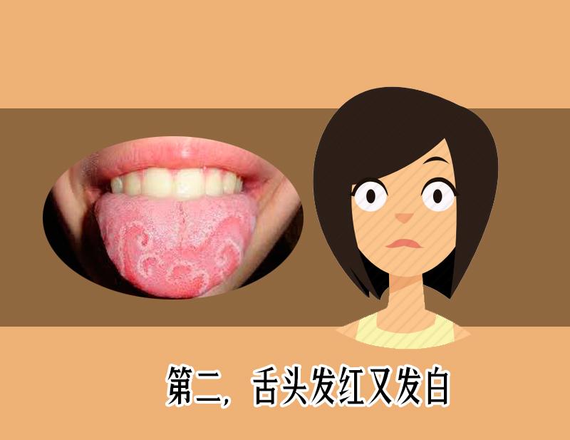 舌苔发黑辨证,舌苔整体发黄警惕四种原因