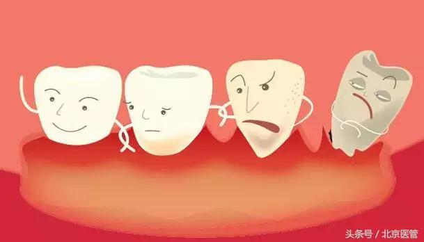 刷牙牙龈老是出血是上火了吗,刷牙牙龈爱出血是上火嘛