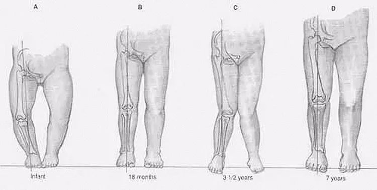 孩子发烧就惊厥推拿方法,小孩发烧惊厥正确处理方法
