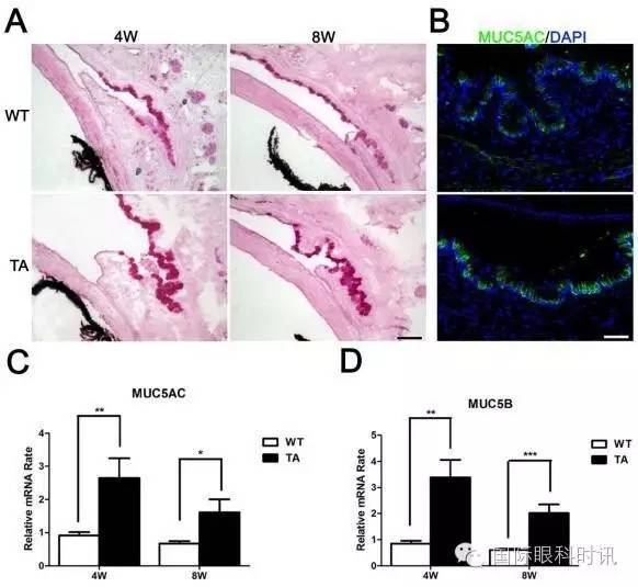 角膜会2016李炜教授:EDA基因突变鼠:一种新的睑板腺功能障碍相关性干眼动物模型