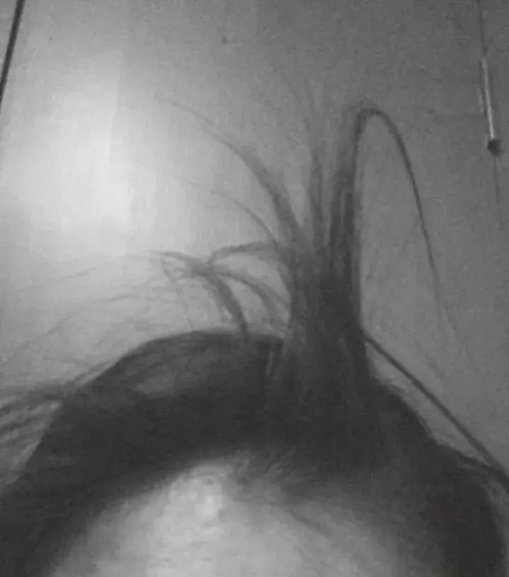 现实中真的有所谓的呆毛吗,呆毛在现实中真的会有吗