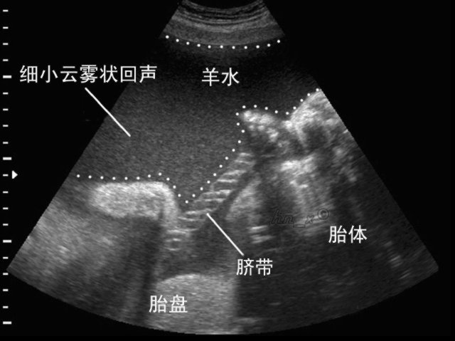 孕期羊水干货知识大全,孕妈妈产检资料收纳册