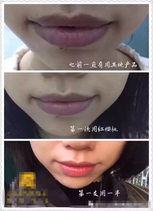 寰晢鍙g孩鐖嗘,涓嵂鎴愬垎鐨勬姢鑲ゅ搧寰晢