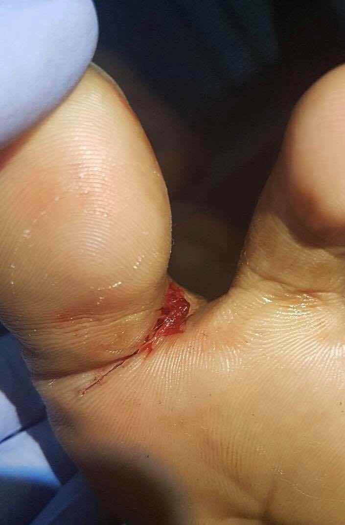 播求最惨的一场视频,播求最可怕的一期