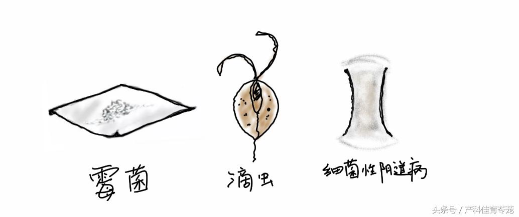 外阴瘙痒可以自愈吗,外阴瘙痒怎么治才会好啊