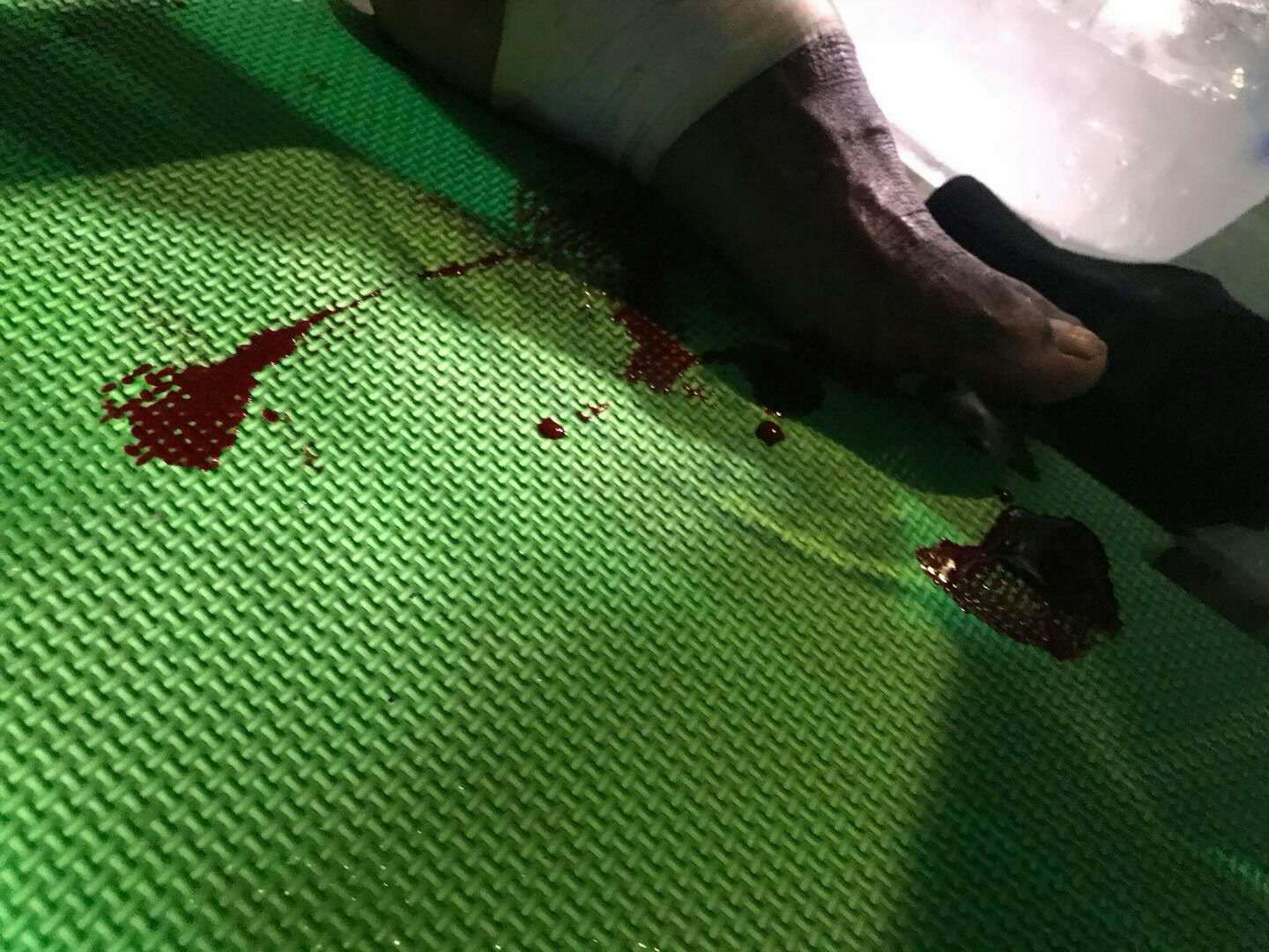 播求头破血流的比赛,播求被扫腿比赛