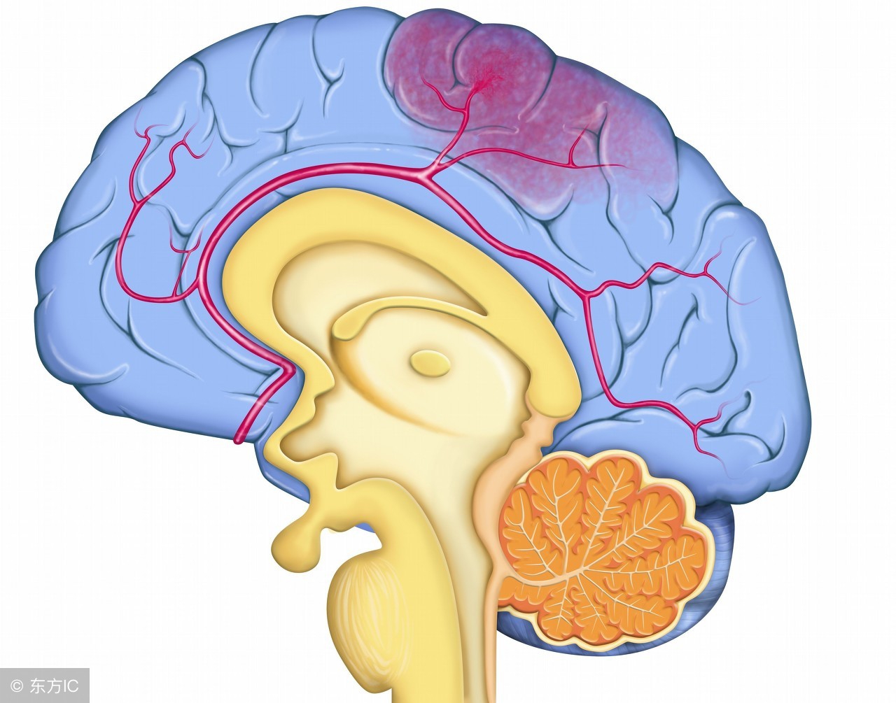 脑供血不足和脑缺血怎么办,脑供血不足的原因及治疗