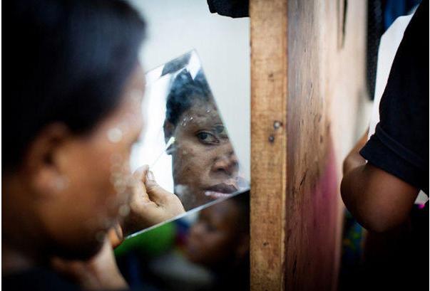 黑人少女把全身漂白，这些美白方式真的靠谱吗？