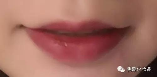 油皮痘肌适合的护肤品牌子,混油皮痘肌适用的护肤品推荐