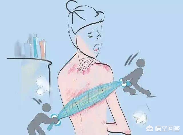 去角质清洁毛孔磨砂膏,磨砂膏能去鸡皮和角质吗