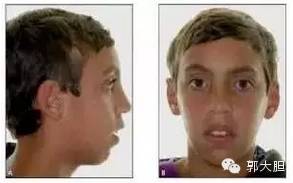 第一次整容日记,整容日记最经典的一段