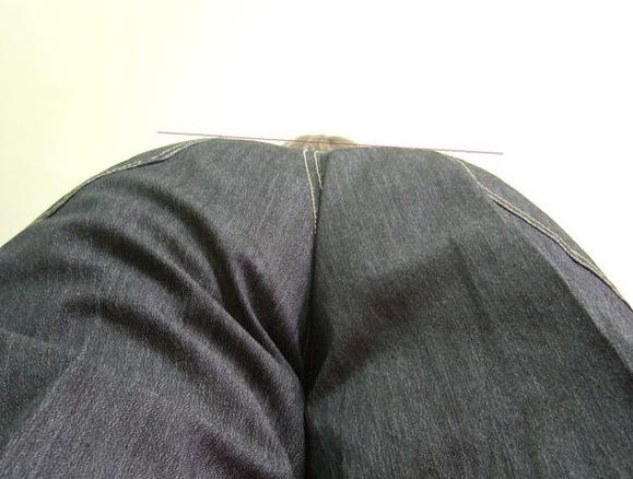 屁股歪了,屁股歪了最佳治疗方法