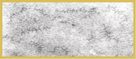 透明质酸护肤品功效,透明质酸是修复皮肤敏感成分