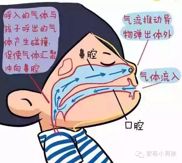宝宝把异物塞到嘴里,宝宝把异物卡到脖子怎么急救