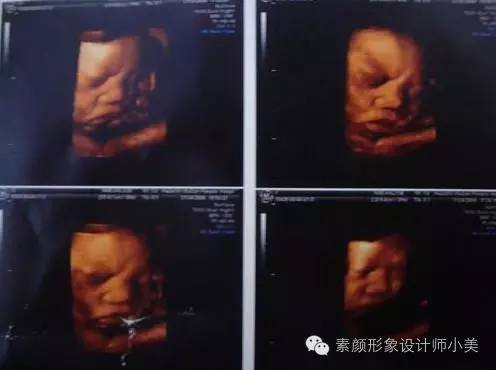 孕育课,孕育课堂分享