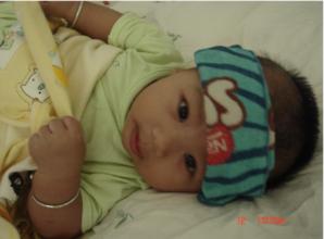 孩子发烧咳嗽，家长不要急着跑医院，试试这些偏方