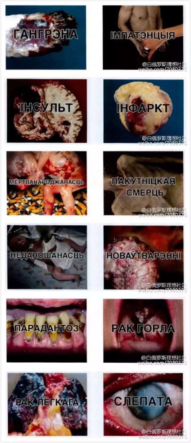 国外烟盒警示图片,看了这些你还想吸烟吗?