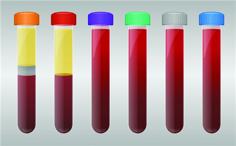 熊猫血献血的时候能不能查出来,熊猫血献血时间