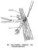 “哪有好医生?”之为什么人人都会得的腱鞘炎,治不好?