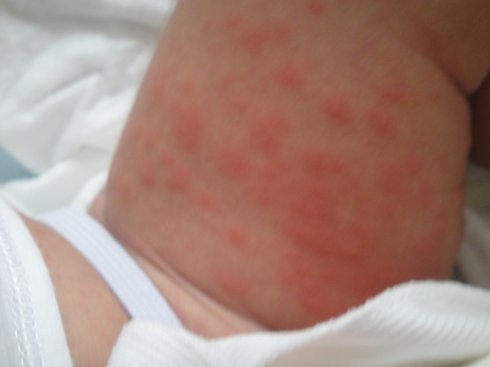 鸡蛋牛奶小麦大米过敏的宝宝辅食,过敏宝宝辅食添加时间顺序和种类