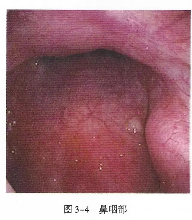 下呼吸道详细图解,必备上呼吸道解剖详解