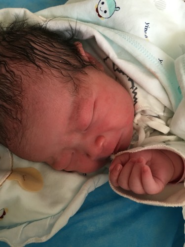 羊水太少是赶紧剖还是顺生,羊水浑浊顺转剖的可能性大吗