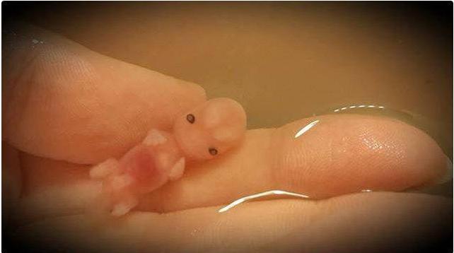 肚子里的孩子停胎了,肚子里孩子停胎了会多久流出来