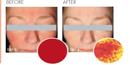 兜兜转转发现最初的才是最好的,法国药妆和日本药妆