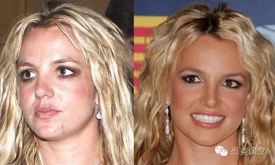 脸再美妆再浓，一颗痘痘毁你容！