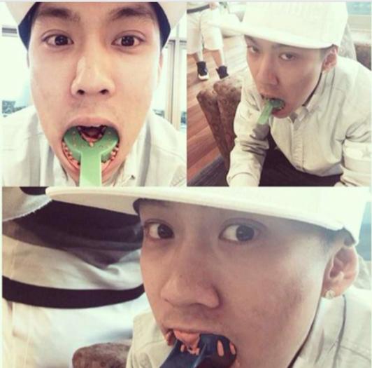 关于最近超火的金牙,你要知道这4件事(起码要知道怎么戴上去吧)