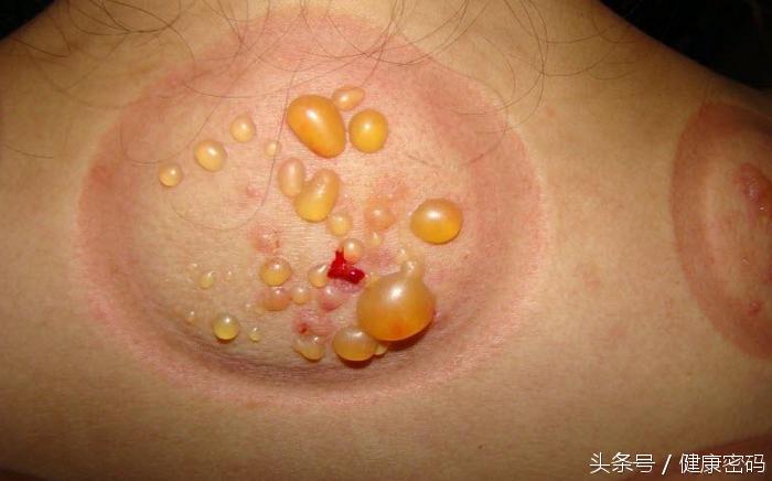 反常，夏天反而长胖了，中医：做好这四点，夏季巧代谢！