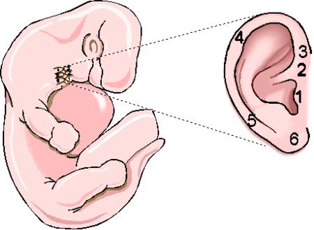 有些人耳朵有一个小洞,有的人耳朵上为什么有小洞洞