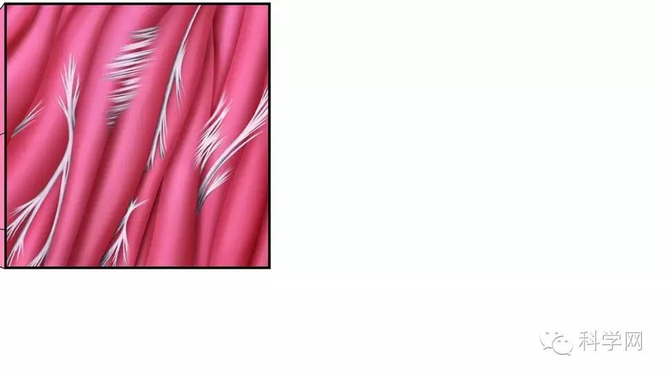 拔火罐怎么拔最有效,拔火罐减肥有效吗