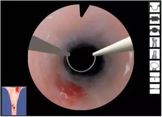 一周左右时胚胎发育成婴儿,胚胎冷冻的宝宝更聪明吗