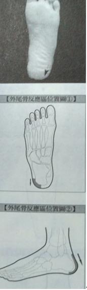 腰椎间盘突出的治疗方法的短视频,腰椎间盘突出的治疗方案有哪些