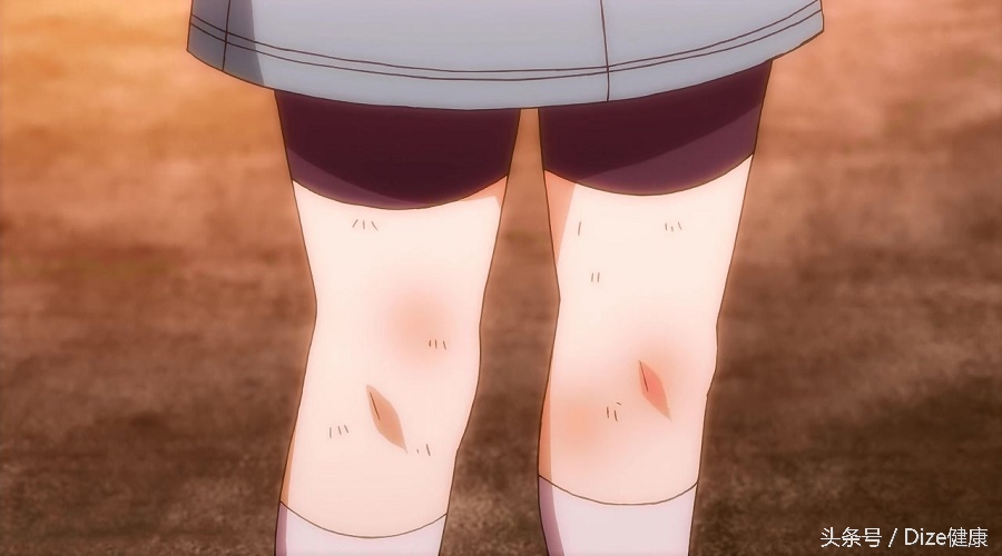 轻轻碰了一下有淤青还痛,轻轻碰一下皮肤就变黑