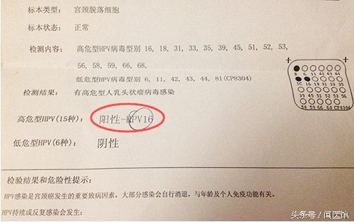 hpv检测e6e7阳性是什么意思,hpv检测阳性之后怎么办