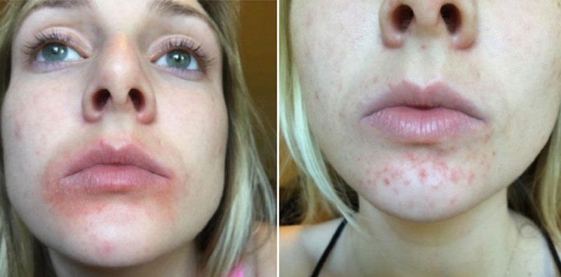 eos唇膏副作用,eos唇膏真伪