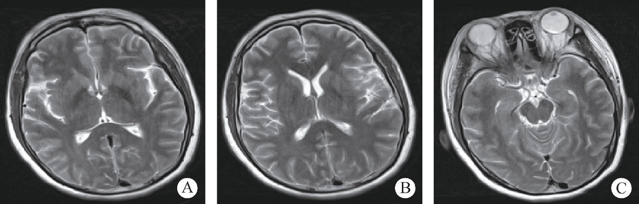 夏季饮水，准妈妈们不要“一次喝个够”