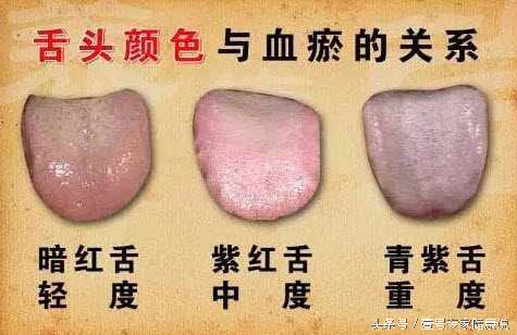 中医说舌头淡是什么原因,中医讲舌头发紫是啥原因